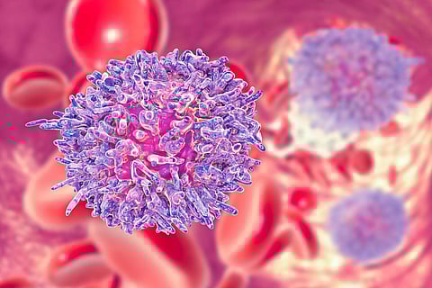 chronic lymphocytic leukemia