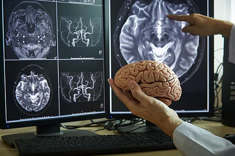 Human brain model on doctor hand. Doctor pointing MRI brain demonstrate brain anatomy