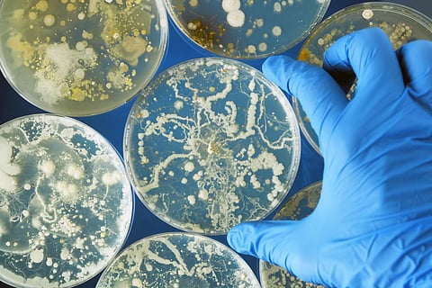 bacteria petri dish infection