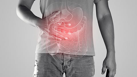 crohn IBD colitis stomach colon IBS