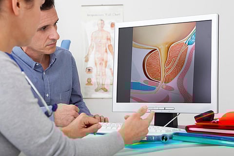 Prostate Cancer Screening 
