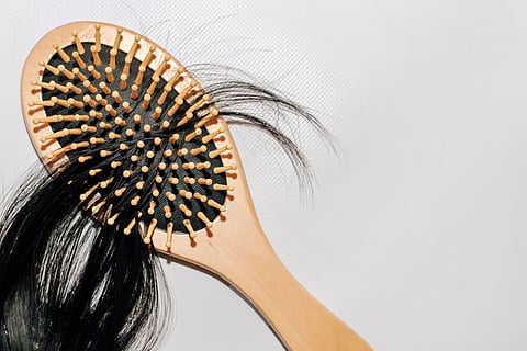 hair loss alopecia