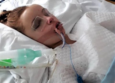 Mia Jack, 18, when she was brought to a U.K. hospital with a traumatic brain injury. She participated in a study that will help better treat brain injuries in young people.