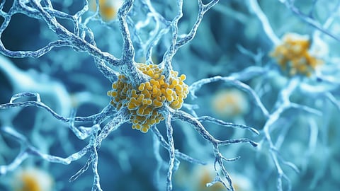 tau alzheimer dementia