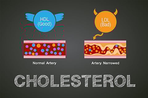 Two-Drug Combo Lowers Cholesterol Better Than Statins Alone
