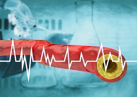 Scoring System Can Avoid Unnecessary Surgery For Clogged Arteries