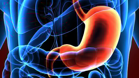 Four-Gene Combo Might Predict Lethality Of Stomach Cancer