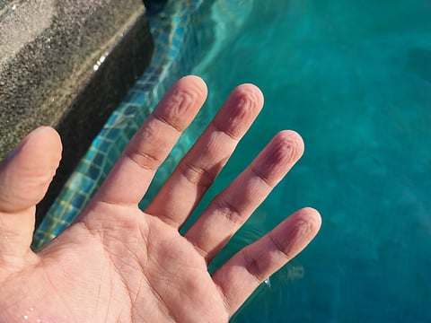 A hand from swim for a long time, withered hand, withered finger.