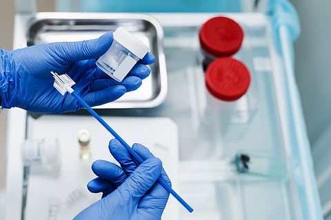 Citología ginecológica, Papanicolaou y citocepillo en manos del ginecólogo. El ginecólogo sostiene un frasco para la citología de la prueba de Papanicolaou en las manos.