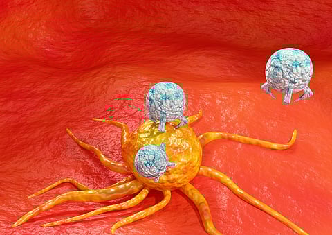 Cancer immunotherapy is a treatment that stimulates the immune system to attack cancer cells and malignant tumors.