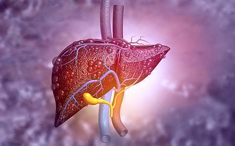 liver disease