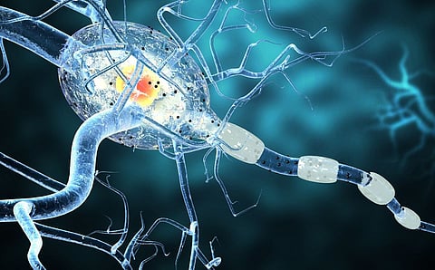 multiple sclerosis neurodegenerative disease