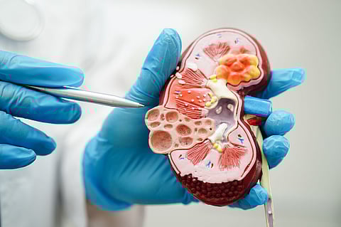 Many High-Risk Patients Miss Out on Full Kidney Disease Screening, Study Finds