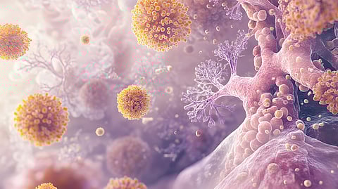 Histoplasmosis Overview