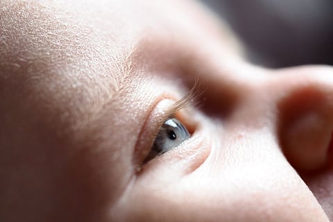 infant eye
