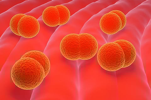 Meningococcus meningitis