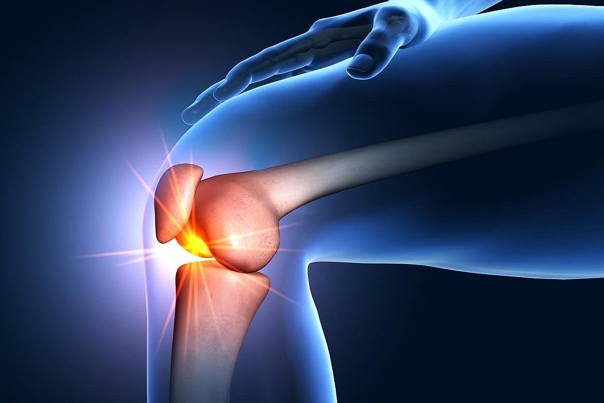 Combining Cannabinoid With Opioid Does Not Relieve Pain in Knee Osteoarthritis