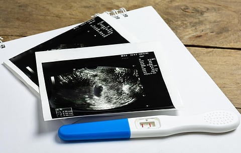 pregnancy test and ultrasound film