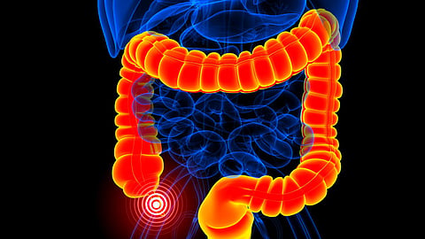 appendix