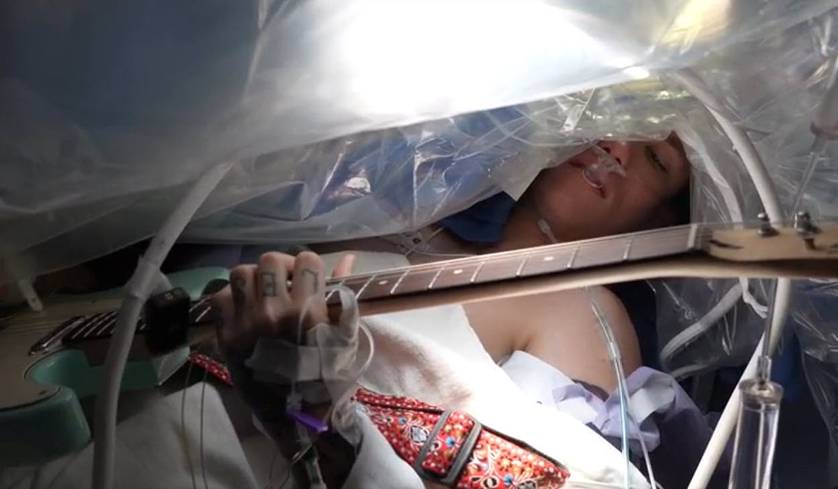 Rock On: He Played Guitar While Getting His Brain Tumor Removed