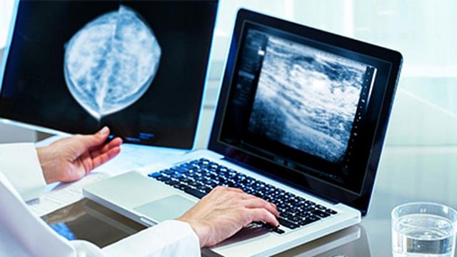 Combined PET/MRI Improves Treatment Decisions in Early Breast Cancer