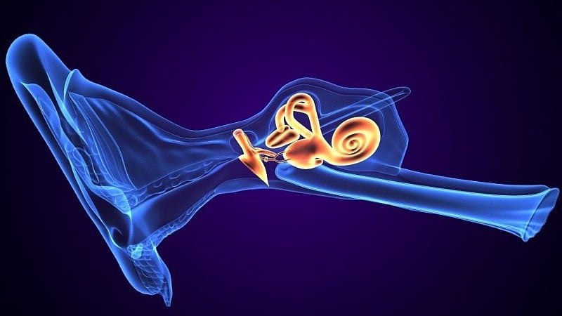 Summating Potential/Action Potential Area Ratio Best to ID Meniere
