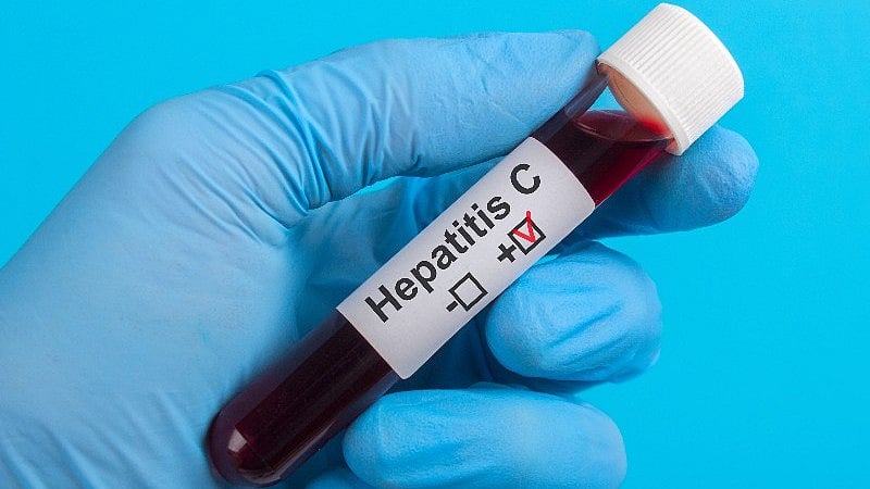 Hep C Infection Poses Global Health Threat to Reproductive-Age Women