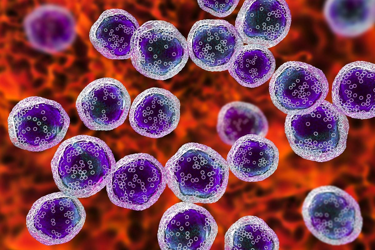 New Hope for People With Aggressive Form of Lymphoma