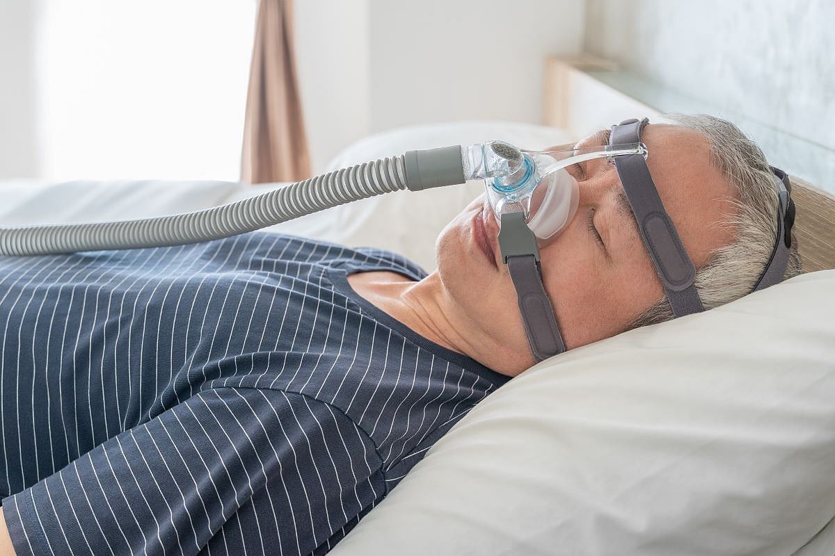 Tirzepatide Reduces Apnea-Hypopnea Index in Moderate-to-Severe OSA