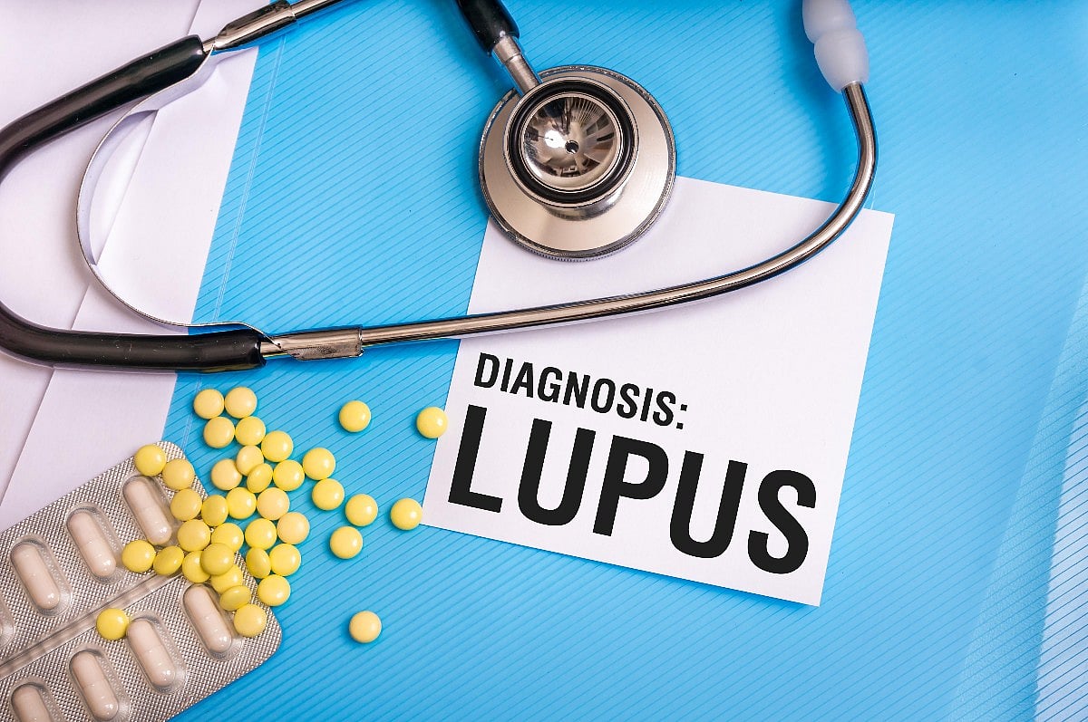 Scientists Spot Cause of Lupus, Way to Reverse It