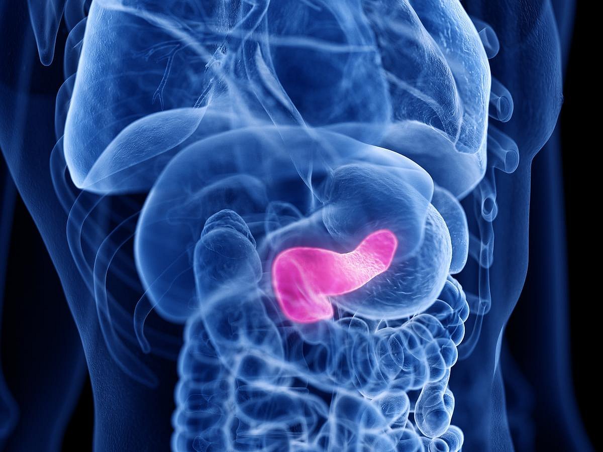 What You Don't Know About Pancreatic Cancer Could Harm You