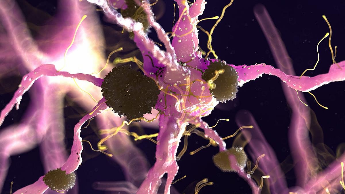 Blood Test Predicts Alzheimer's Years Before Symptoms, Brain Changes
