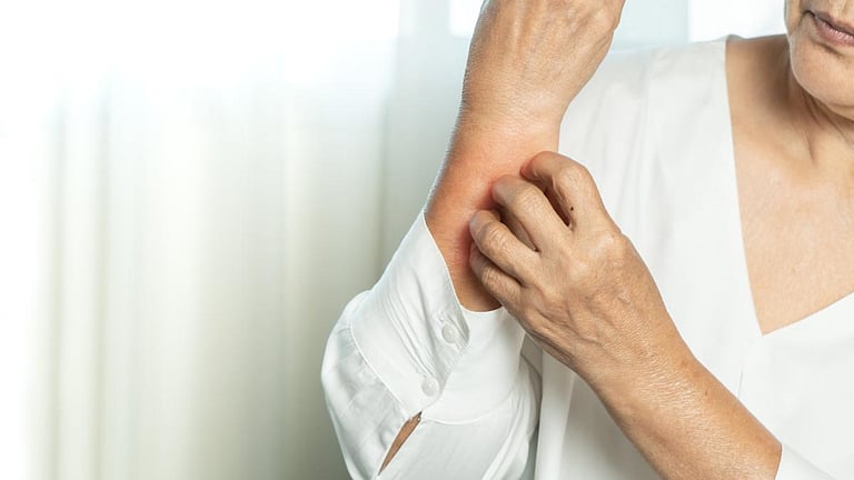 Chronic Pruritus Prevalent Among Older Adults