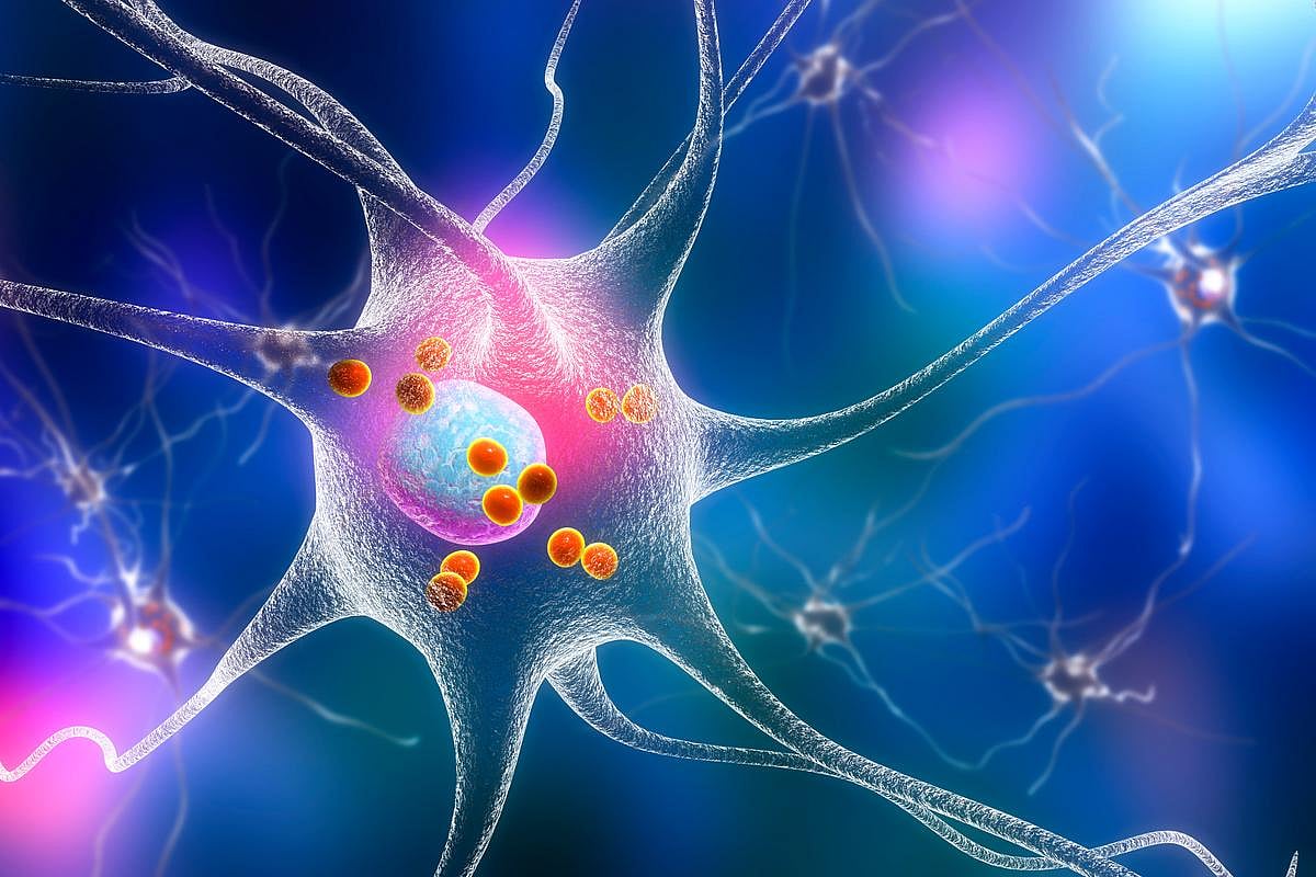 New Approach to Fight Huntington's Disease Shows Early Promise