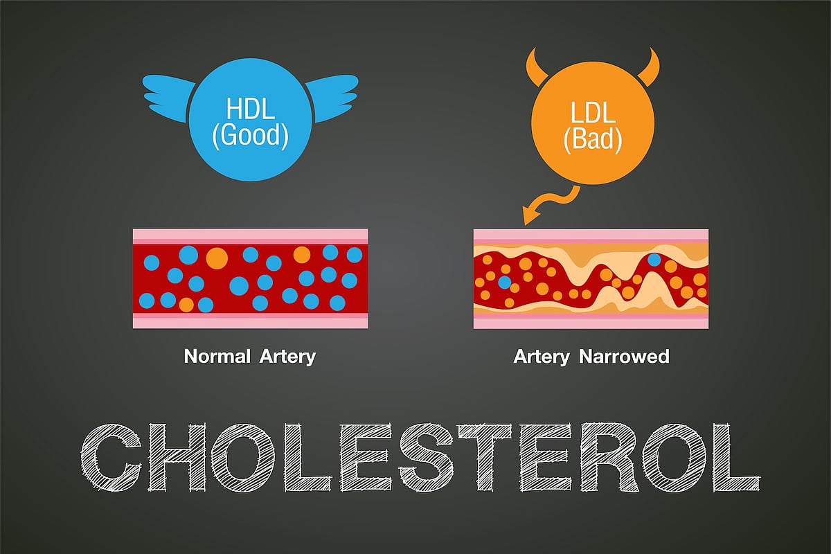 Two-Drug Combo Lowers Cholesterol Better Than Statins Alone