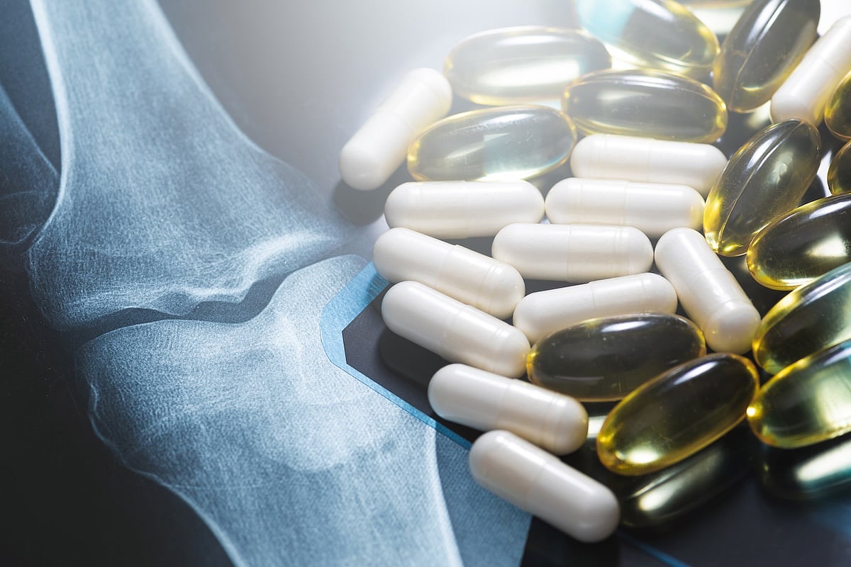 Popular Joint Pain Supplement Might Increase Alzheimer's Risk, Study Says