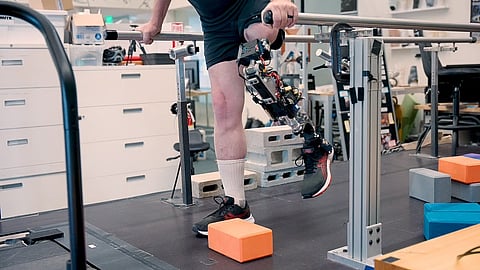 バイオニック膝関節を用いた義足で下肢切断患者の動きが改善