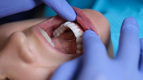 口の中の健康状態が生活習慣病リスクを高める可能性