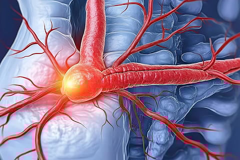 赤肉の摂取は腹部大動脈瘤の発症につながる？