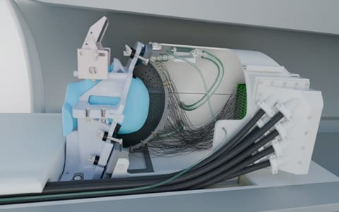 超音波ヘルメットによって手術なしで脳刺激療法が可能に