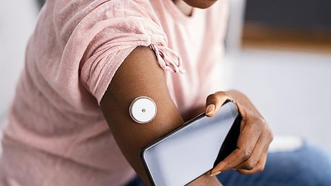 抗胸腺細胞グロブリンが1型糖尿病発症早期のβ細胞機能低下を抑制