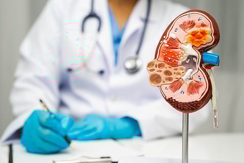 代謝異常を伴う脂肪肝「MASLD」、慢性腎臓病の独立リスクに