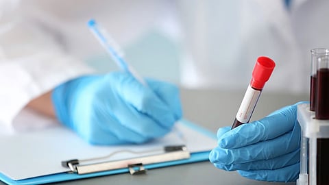 血液培養汚染の定義は医療機関によって異なる