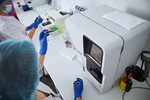 “血小板の大きさ”が知らせる腎臓の危険信号、糖尿病患者の追跡調査で判明