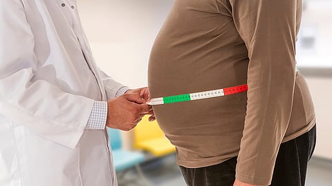 重度肥満のリスクをもたらす遺伝子を新たに同定