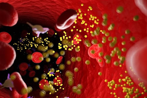 開発中の新薬でLDL-C値の大幅な低下を確認