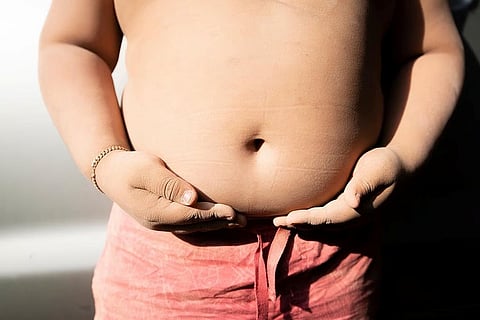 幼少期の逆境体験が多いほど肥満リスク上昇、支える大人が保護因子の可能性