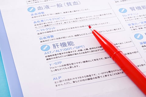 AST・ALTは季節で変動、MASLDスクリーニング判定への影響示唆