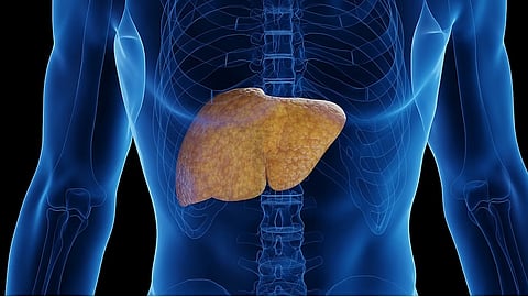 飲酒量が線維化リスクに及ぼす影響は性別や肝疾患の種類によって異なる