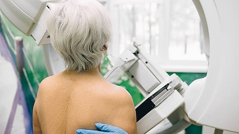 乳がん検診の過剰診断はこれまで考えられていたよりも少ない？